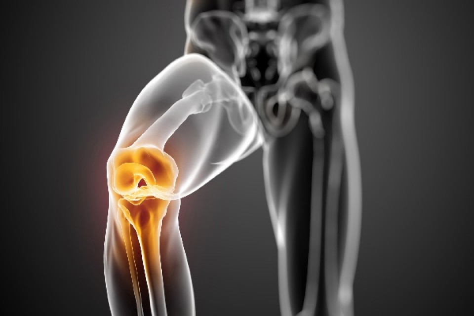 knee replacement in Delhi