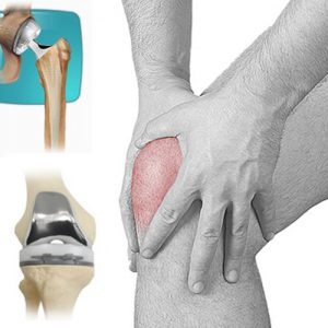 joint-replacement-300x300